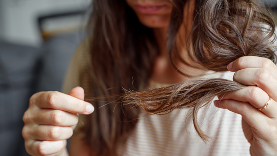 Comment prévenir la chute de cheveux : Conseils et traitements